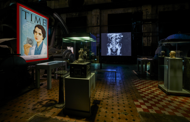 X Ray 33 b