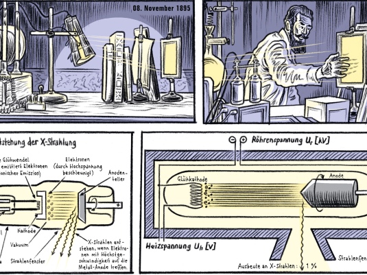 THE X RAY STORY SF
